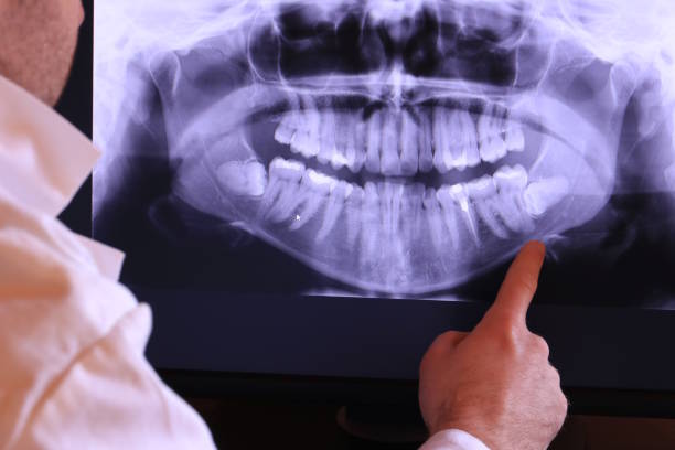 Best Emergency Root Canal Treatment in Wedgefield, SC